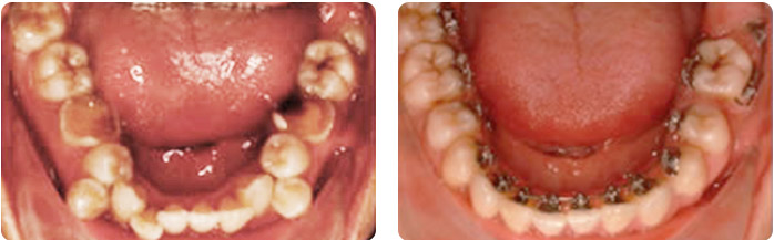 Сложная и сочетанная патология в ортодонтии